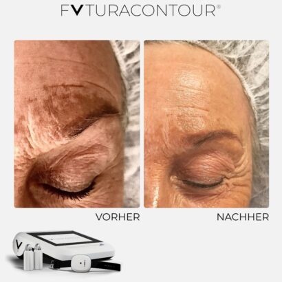 DA Beauty Nordisch Schön Lübeck Permanent Make-Up, FVTURACONTOUR®