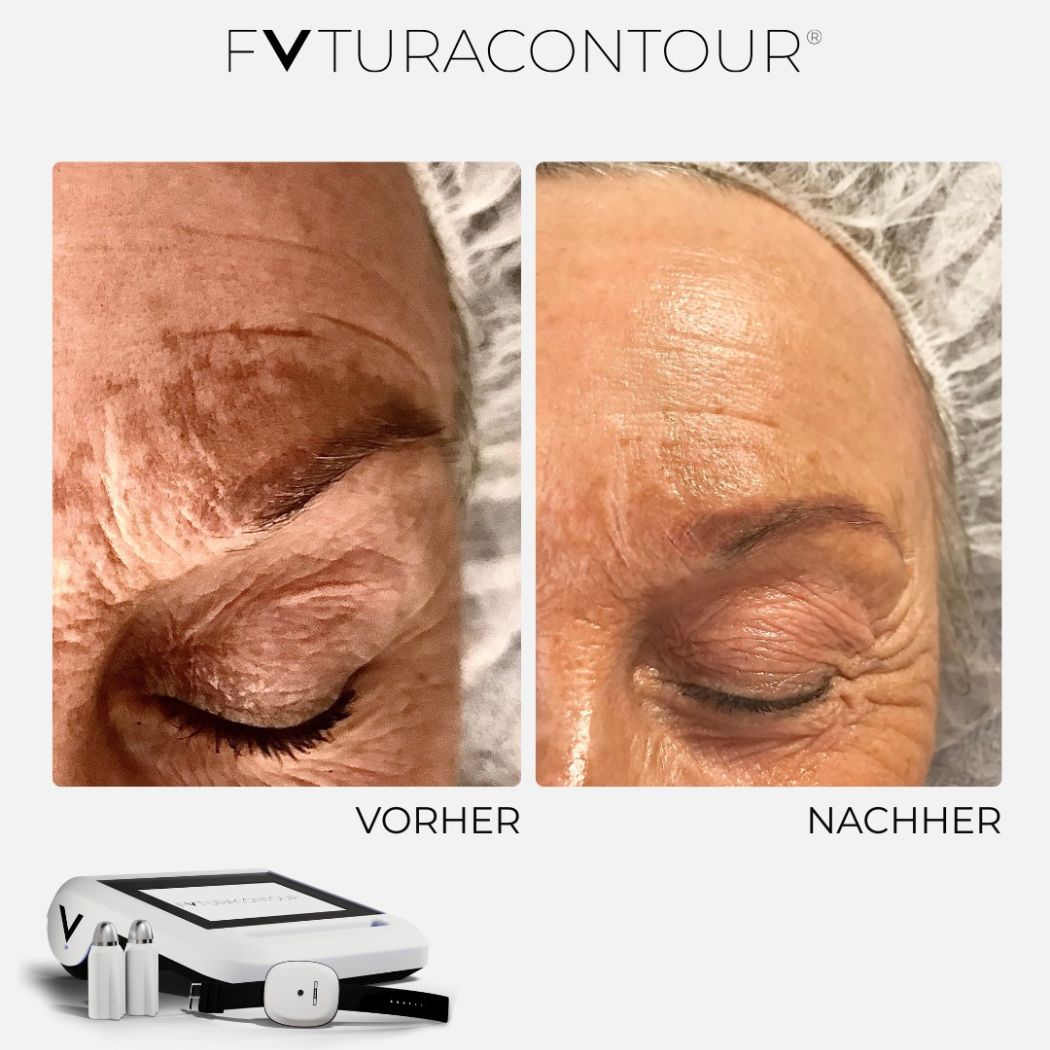 FVTURACONTOUR® DA Beauty Nordisch Schön Lübeck