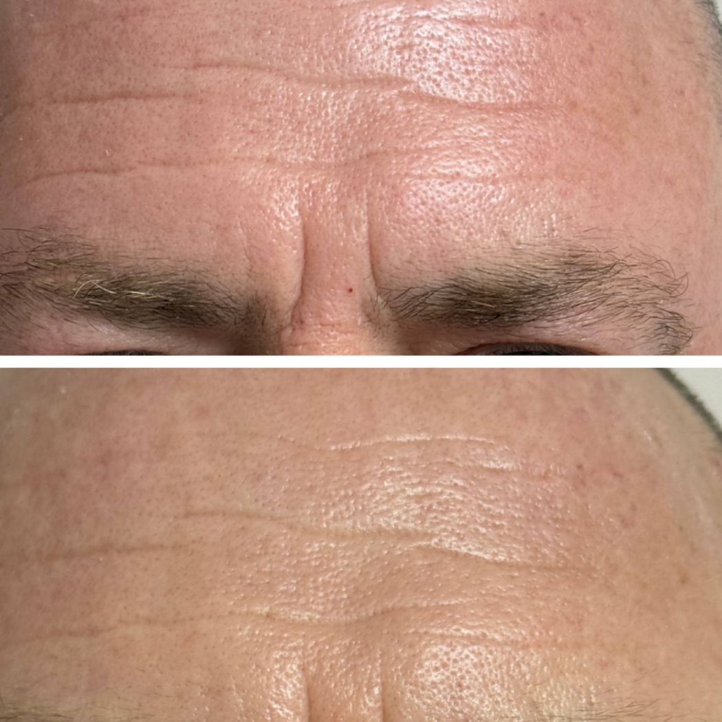 FVTURACONTOUR® DA Beauty Nordisch Schön Lübeck